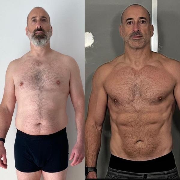 Gareth — before and after